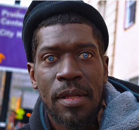 black men with blue eyes|black person with heterochromia.